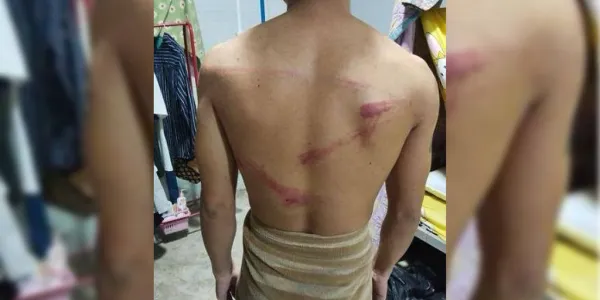 19 เหยื่อค้ามนุษย์ชาวลาว วิงวอนผู้นำไทยช่วยเหลือ หลังถูกกักขังทรมานในแหล่งอาชญากรรมริมน้ำเมยฝั่งพม่า พร้อมแฉกลวิธีหลอกเหยื่อบังคับทำงานสแกมเมอร์ ใช้ 'TikTok' ตุ๋นทั่วโลก ใช้ไทยเป็นทางผ่าน